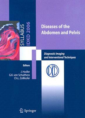 【预订】Diseases of the abdomen and Pelvis