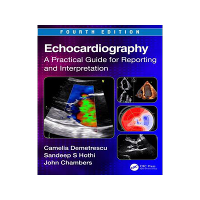 [预订]Echocardiography 9781032151588