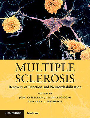 【预订】Multiple Sclerosis