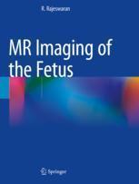 [预订]MR Imaging of the Fetus 9789811692116