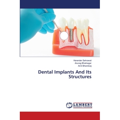 预订 Dental Implants And Its Structures: 9786203472240