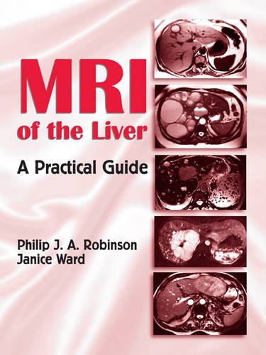【预订】MRI of the Liver