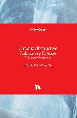 [预订]Chronic Obstructive Pulmonary Disease: A Current Conspectus 9781839689260