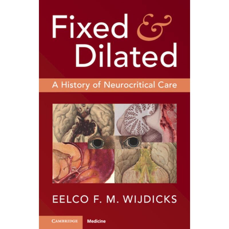 预订 Fixed and Dilated A History of Neurocritical Care 瞳孔的收缩与散大:神经重症医学史 9781009391542