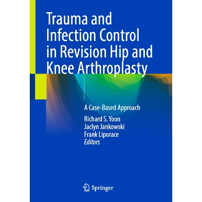 预订 Trauma and Infection Control in Revision Hip and Knee Arthroplasty: A Case-Based Approach 髋关节与膝关节翻修术中的