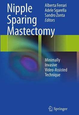 预订 Nipple Sparing Mastectomy