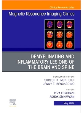 电子书 Demyelinating and Inflammatory Lesions of the Brain and Spine, An Issue of Magnetic Resonance Imaging Clinics of