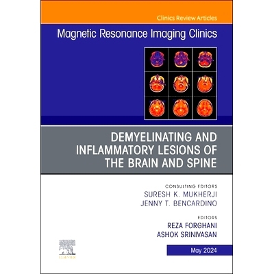 电子书 Demyelinating and Inflammatory Lesions of the Brain and Spine, An Issue of Magnetic Resonance Imaging Clinics of