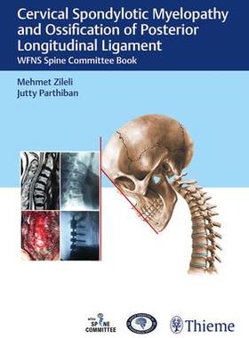 [预订]Cervical Spondylotic Myelopathy and Ossification of Posterior Longitudinal Ligament 9789390553204