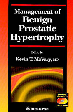 【预订】Management of Benign Prostatic Hypertrophy