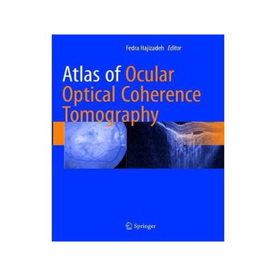 预订 Atlas of Ocular Optical Coherence Tomography