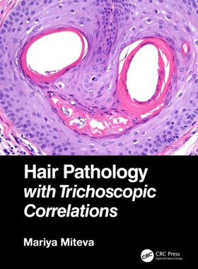【预订】Hair Pathology with Trichoscopic Correlations 9781138313538