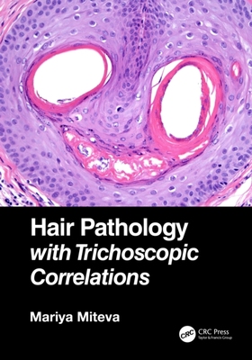 【预订】Hair Pathology with Trichoscopic Correlations 9781138313538