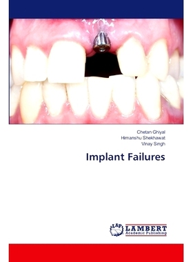 预订 Implant Failures: 9783659925276