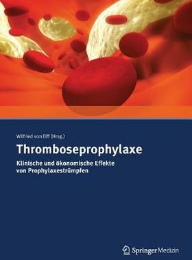 预订 Thromboseprophylaxe Klinische und ökonomische Effekte von Prophylaxestrümpfen