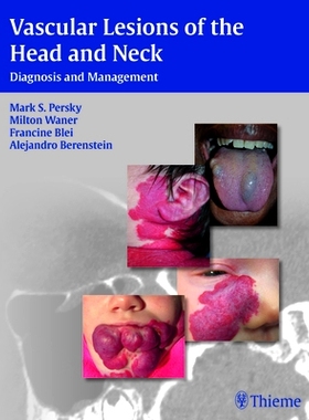 预订 Vascular Lesions of the Head and Neck: Diagnosis and Management 头颈部血管病变: 9781604060591