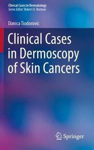 【预订】Clinical Cases in Dermoscopy of Skin Cancers