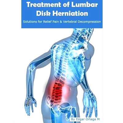 预订 Treatment of Lumbar Disk Herniation: Back Pain Relief and Herniated Discs Solutions: 9781312572430