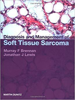 【预售】Diagnosis and Management of Soft Tissue Sarcoma