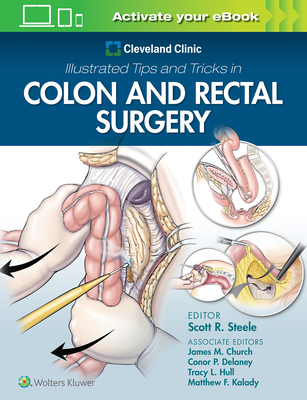 【预订】Cleveland Clinic Illustrated Tips and Tricks in Colon and Rectal Surgery