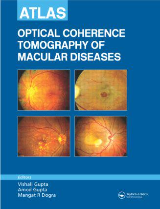 【预订】Atlas of Optical Coherence Tomography of Macular Diseases