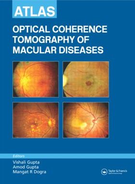 【预订】Atlas of Optical Coherence Tomography of Macular Diseases