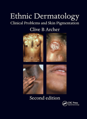 【预订】Ethnic Dermatology: Clinical Problems and Skin Pigmentation