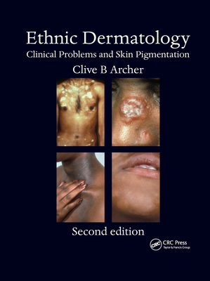 【预订】Ethnic Dermatology: Clinical Problems and Skin Pigmentation