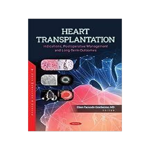 [预订]Heart Transplantation: Indications, Postoperative Management and Long-Term Outcomes 9781685077594
