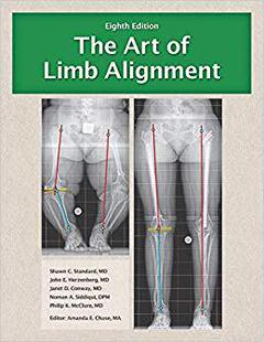 Limb Alignment Art 预售 The