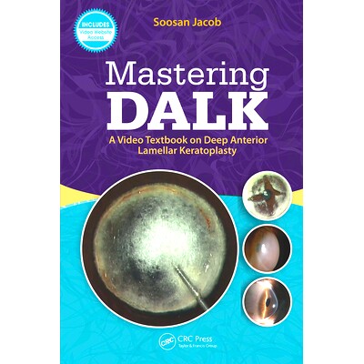 预订 Mastering DALK: A Video Textbook on Deep Anterior Lamellar Kera*lasty 掌握深层前角膜移植:深板层角膜移植术的影像学