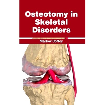 预订 Osteotomy in Skeletal Disorders 骨骼疾病的截骨术: 9781632413109