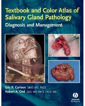 【预订】Textbook And Color Atlas Of Salivary Gland Pathology 9780813802626