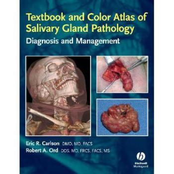 【预订】Textbook And Color Atlas Of Salivary Gland Pathology 9780813802626