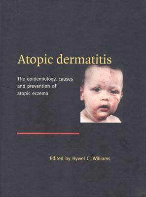 国外库房发货,通常付款后5-8周到货!