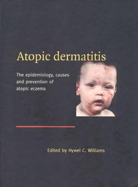 【预订】Atopic Dermatitis