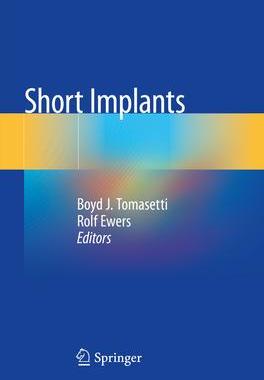 [预订]Short Implants 9783030442019
