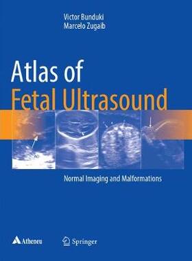 预订 Atlas of Fetal Ultrasound