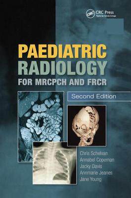 【预订】Paediatric Radiology for MRCPCH and FRCR, Second Edition
