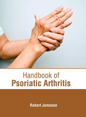 [预订]Handbook of Psoriatic Arthritis 9781639273959