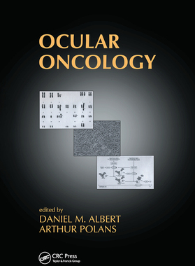 【预订】Ocular Oncology