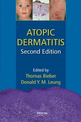 【预订】Atopic Dermatitis, Second Edition