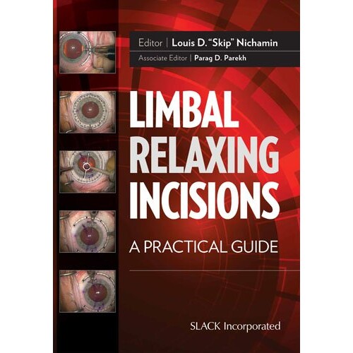 预订 Limbal Relaxing Incisions A Practical Guide 角膜缘松弛切口:实用指南 9781617118388
