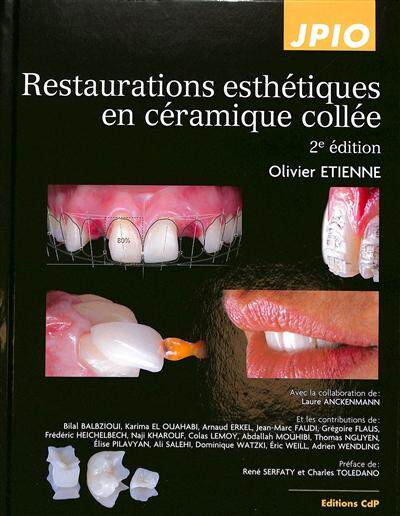 预订 Restaurations esthétiques en céramique collée