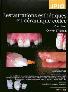 预订 Restaurations esthétiques en céramique collée