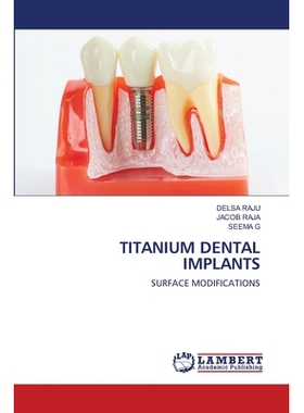 预订 Titanium Dental Implants: 9786203464344