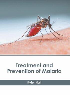 [预订]Treatment and Prevention of Malaria 9781639895311
