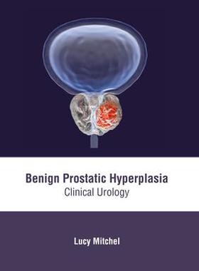 [预订]Benign Prostatic Hyperplasia: Clinical Urology 9781632419163
