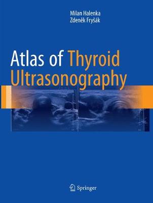 【预订】Atlas of Thyroid Ultrasonography