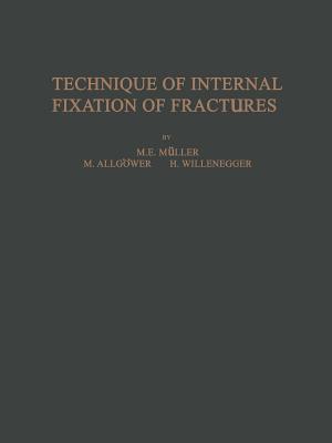 【预订】Technique of Internal Fixation of Fractures
